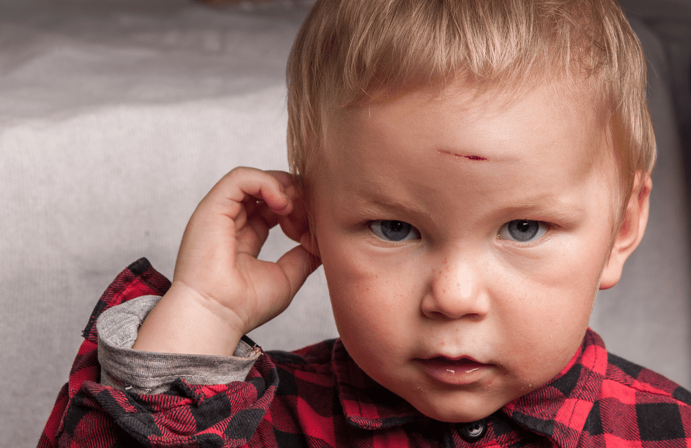Children Head Injuries